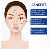 Aziclear Anti Acne Facial Cleanser, 100ml