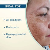 FCL C Scape 25 Serum with 25% Vitamin C Serum, 30ml