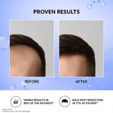 Mintop Forte 10% Solution, 60ml