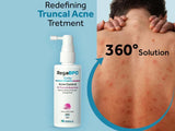 Rega-BPO Acne Control Body Spray, 60ml