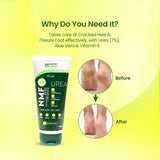 NMFe Urea Cream 150gm